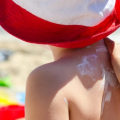 The Risks of Excessive Sun Exposure