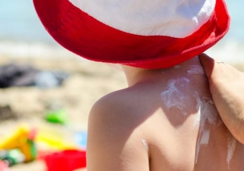 The Risks of Excessive Sun Exposure